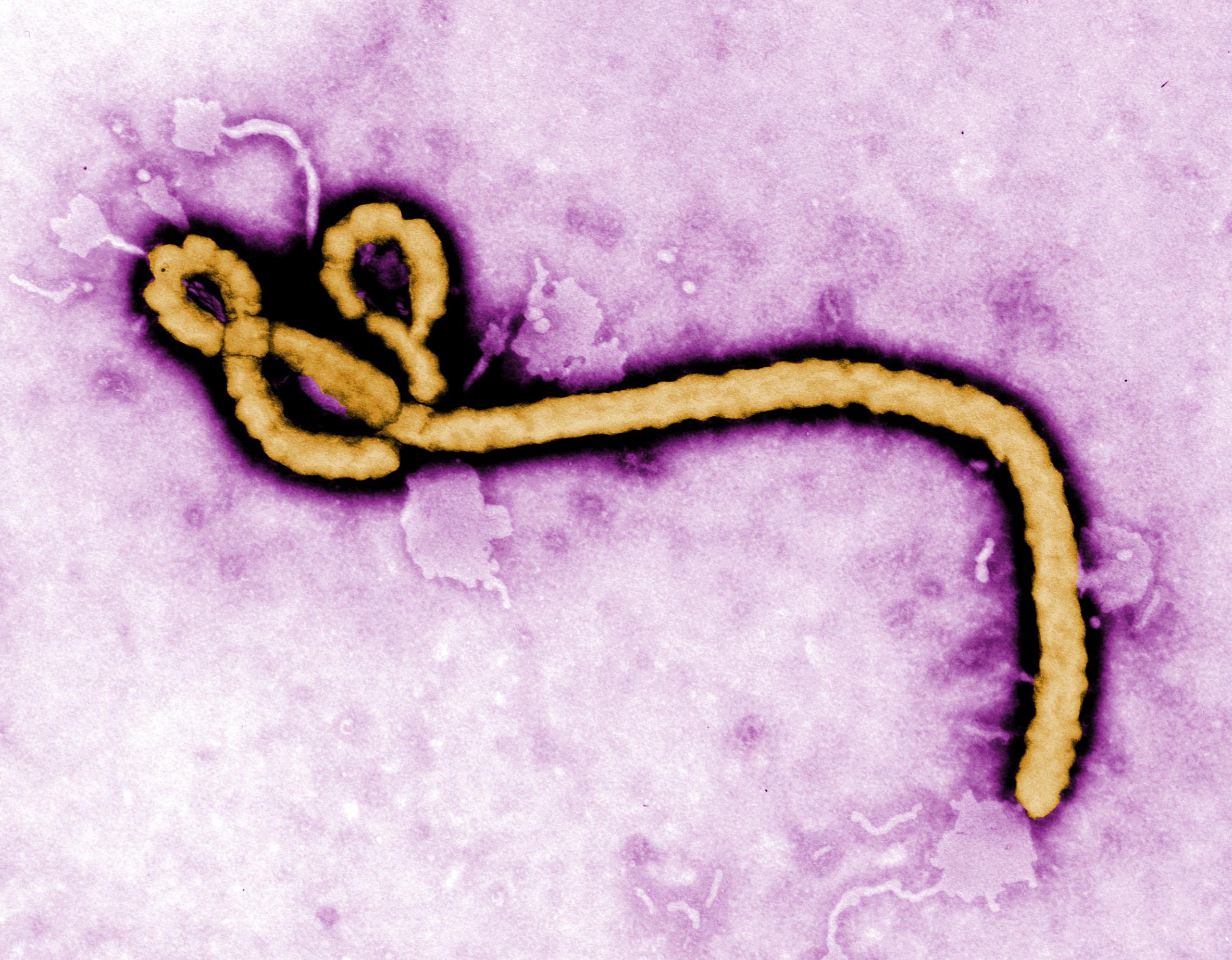 virus Ebola