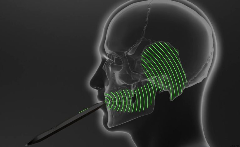 Bone Conduction: A Discreet Pen for Listening to Football Matches — A Marketing Masterstroke the Public Missed