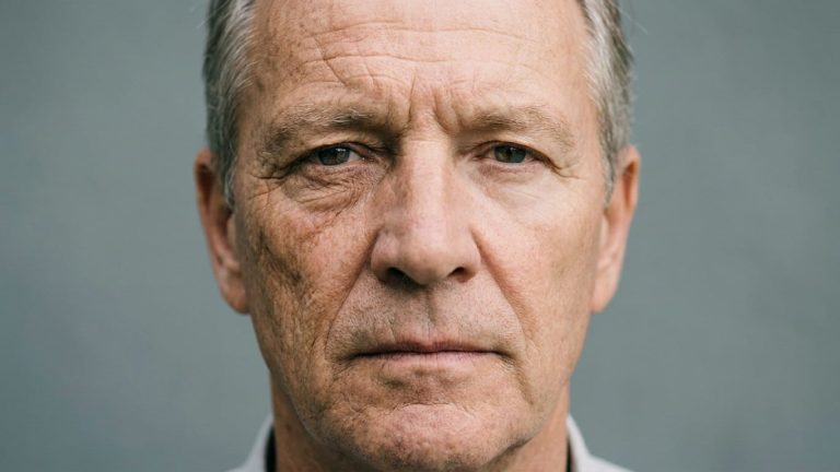 Delivery Driver Who Drove with Windows Closed for Years Literally Aged One Side of His Face